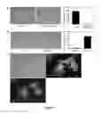 Fig. 08 - Method of binding a CSE1L tumor marker in a tumor of an animal