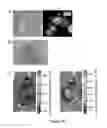 Fig. 11 - Method of binding a CSE1L tumor marker in a tumor of an animal