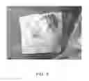 Fig. 04 - Hemostatic sponge