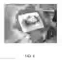 Fig. 05 - Hemostatic sponge
