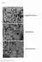 Fig. 10 - Gene delivery stent using titanium oxide thin film coating and method for fabricating the same