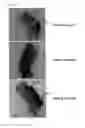 Fig. 11 - Gene delivery stent using titanium oxide thin film coating and method for fabricating the same