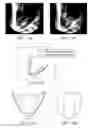 Fig. 09 - Cardiac compression device having passive and active chambers