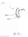 Fig. 04 - Fluid cassette with alignment latching having an improved tilt-tolerance as well as a blood treatment apparatus