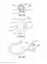 Fig. 06 - Insertion mechanism for a drug delivery pump