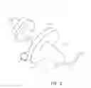 Fig. 04 - Active smoke filtration for insufflation