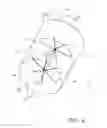 Fig. 05 - Active smoke filtration for insufflation