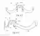 Fig. 15 - Mask system