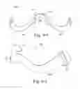 Fig. 16 - Mask system