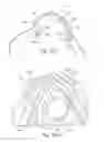 Fig. 35 - Mask system