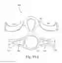 Fig. 47 - Mask system