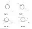 Fig. 03 - CATHETER WITH ASYMMETRIC CROSS-SECTION