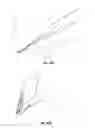 Fig. 08 - CATHETER WITH ASYMMETRIC CROSS-SECTION