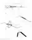 Fig. 03 - INTRAVASCULAR TISSUE DISRUPTION
