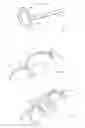Fig. 05 - INTRAVASCULAR TISSUE DISRUPTION