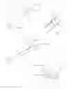 Fig. 08 - INTRAVASCULAR TISSUE DISRUPTION