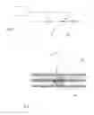 Fig. 15 - INTRAVASCULAR TISSUE DISRUPTION