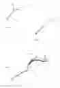 Fig. 16 - INTRAVASCULAR TISSUE DISRUPTION