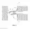 Fig. 02 - SYSTEM AND PROCEDURE FOR PLACING A MEDICAL DEVICE PROXIMATE AN OSTIAL LESION USING A CATHETER ASSEMBLY