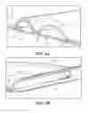 Fig. 05 - Catheter connection and stabilization device and methods of using same