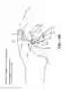 Fig. 18 - Catheter connection and stabilization device and methods of using same