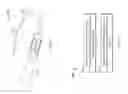 Fig. 08 - Guidewire for cannula placement