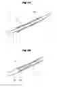Fig. 06 - Biliary tract drainage tube