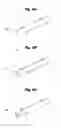Fig. 07 - Biliary tract drainage tube