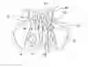 Fig. 01 - BALLOON CATHETERS AND METHODS FOR TREATING PARANASAL SINUSES