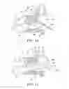 Fig. 07 - BALLOON CATHETERS AND METHODS FOR TREATING PARANASAL SINUSES
