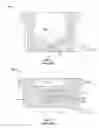 Fig. 02 - HEMOSTATIC VALVE FOR HEART PUMP INTRODUCER