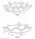 Fig. 15 - Systems for increasing a delay in the gastric emptying time for a patient using a transcutaneous electro-dermal patch