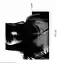 Fig. 99 - Systems for increasing a delay in the gastric emptying time for a patient using a transcutaneous electro-dermal patch