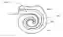 Fig. 01 - Hearing prosthesis electrode array with resiliently flexible tip member