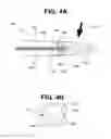Fig. 04 - Hearing prosthesis electrode array with resiliently flexible tip member