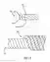Fig. 07 - COILED LEAD ASSEMBLY FOR NEUROSTIMULATION