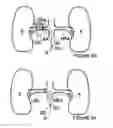 Fig. 08 - Methods and apparatus for bilateral renal neuromodulation