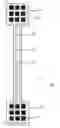 Fig. 01 - Method of manufacturing a flexible conductive track arrangement, flexible conductive track arrangement and neurostimulation system