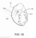 Fig. 03 - ENGAGEMENT AND DELIVERY CATHETER SYSTEMS