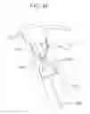 Fig. 09 - ENGAGEMENT AND DELIVERY CATHETER SYSTEMS