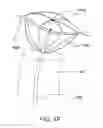 Fig. 10 - ENGAGEMENT AND DELIVERY CATHETER SYSTEMS