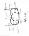 Fig. 22 - ENGAGEMENT AND DELIVERY CATHETER SYSTEMS