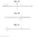 Fig. 02 - Apparatus and methods for assisted breathing by transvascular nerve stimulation