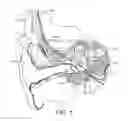 Fig. 02 - Interaural coherence based cochlear stimulation using adapted fine structure processing