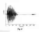 Fig. 08 - Interaural coherence based cochlear stimulation using adapted fine structure processing