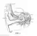 Fig. 02 - Interaural coherence based cochlear stimulation using adapted envelope processing