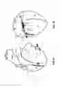 Fig. 02 - Methods and devices for multi-stage ventricular therapy
