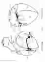 Fig. 06 - Methods and devices for multi-stage ventricular therapy