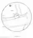 Fig. 17 - TWO-PART PULSED ELECTROMAGNETIC FIELD APPLICATOR FOR APPLICATION OF THERAPEUTIC ENERGY