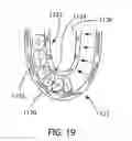 Fig. 14 - INTRA-ORAL LIGHT-THERAPY APPARATUSES AND METHODS FOR THEIR USE